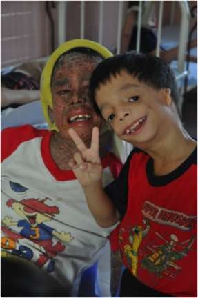 Agent Orange Boys at Tu Du Hospital in Vietnam (photo by Brendan Wilcox, courtesy of Seven Stories Press)